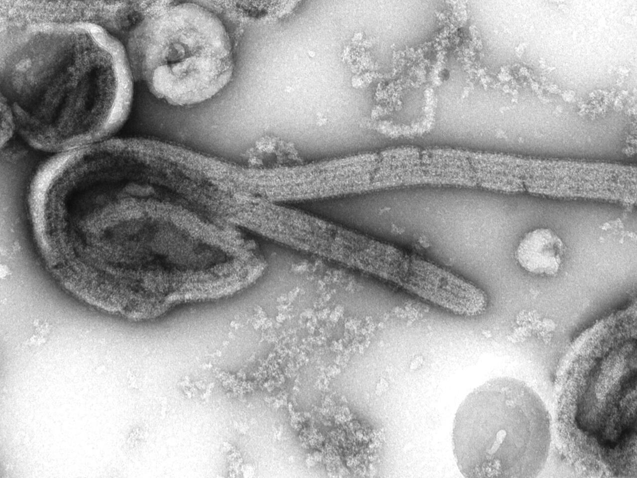 La Tanzanie confirme cinq morts du virus de Marburg dans le pays