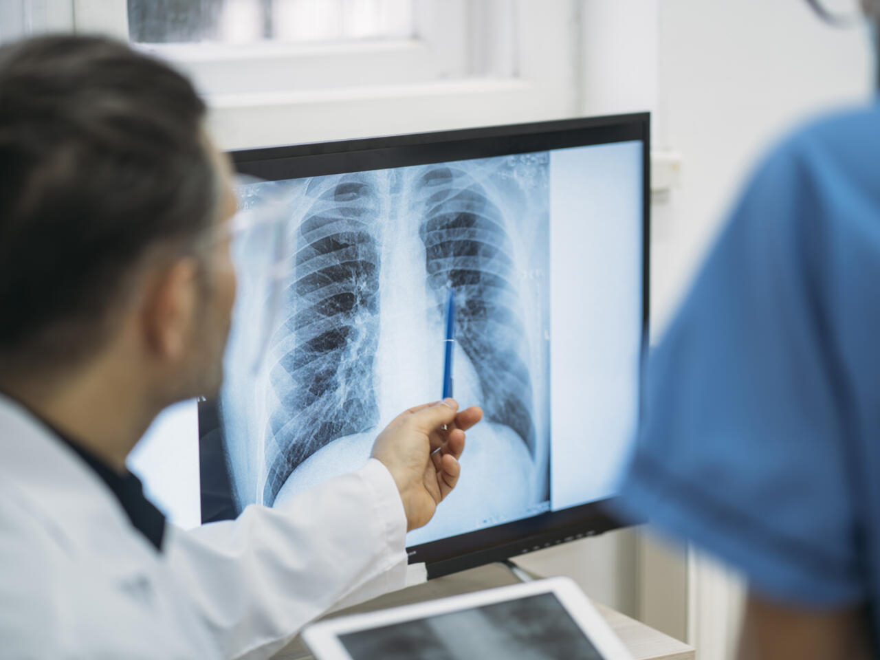 La pandémie de Covid-19 fait repartir les cas de tuberculose à la hausse